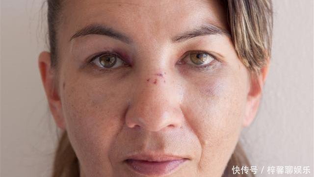 脾虚百病生，脾虚的人有哪些症状记住3个妙招，脾胃慢慢变强大