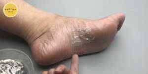 阿司匹林加牙膏,作用好厉害,解决了好多人一大困扰,告知家里人