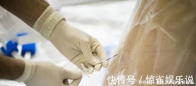 宝妈|国家力推“无痛分娩针”,便宜又好用,为何孕妈宁愿疼哭都不打?