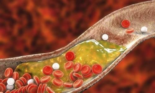 维生素c|多走路可以降血脂?提醒:平时多吃这4种食物,或比走路效果好