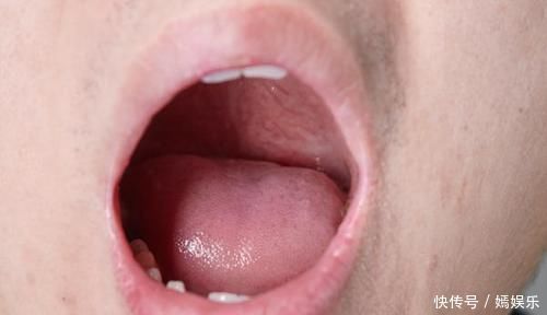 为什么睡到半夜,总感觉嘴里很干,还泛苦是身体哪出了问题