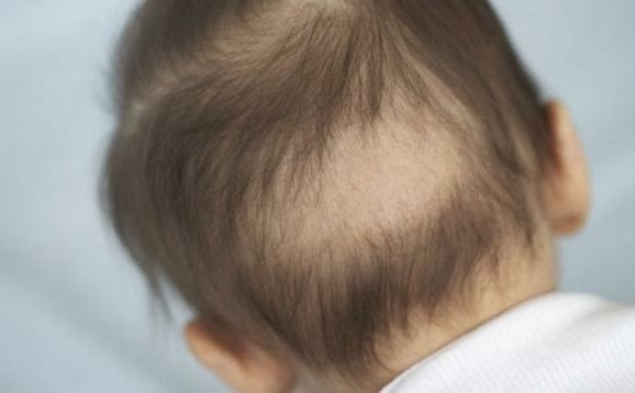 男孩|13岁初三男孩一年身高增15CM,1物有助身高“增长”,秋季可多吃