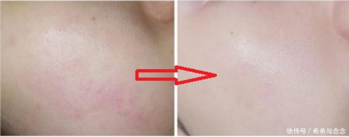 二胎辣妈爆火的怀孕护肤“3+2法则”！精明孕妈才能越孕越美丽！