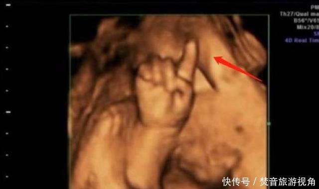 算数|“天才”胎儿走红,还在妈妈肚里就会“算数”,医生清华北大等你