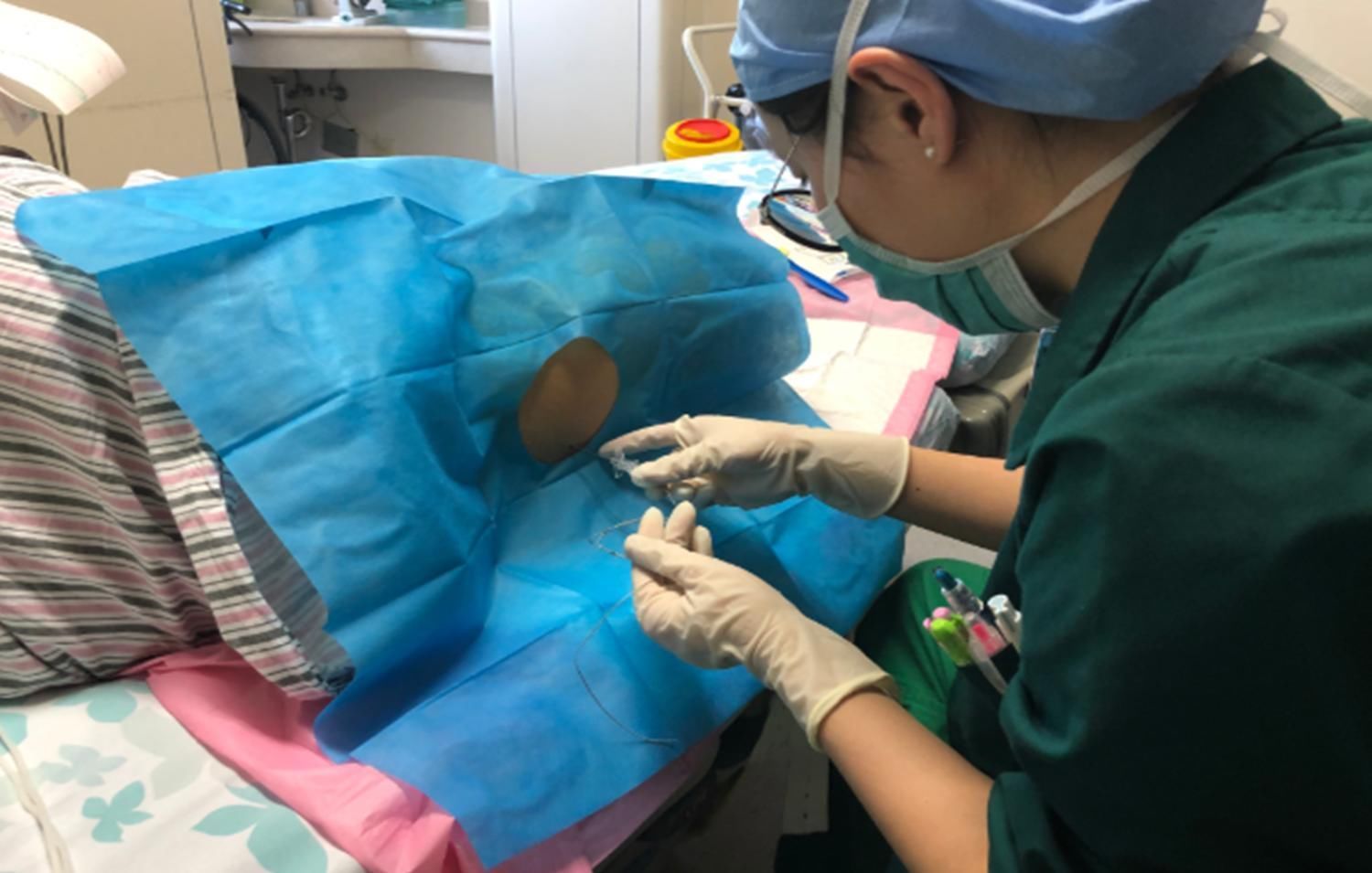 宁愿肚子上留疤,也不愿意顺产,女明星为什么会如此钟爱剖腹产