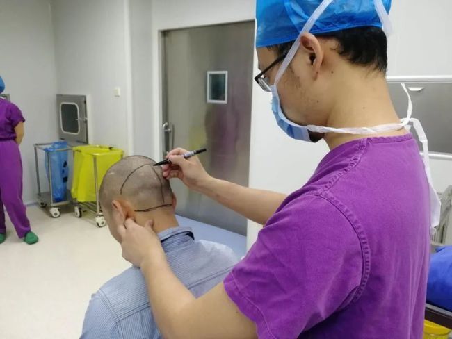 脱发|“来晚了……”25岁帅小伙掉发没在意，医生的话让他崩溃