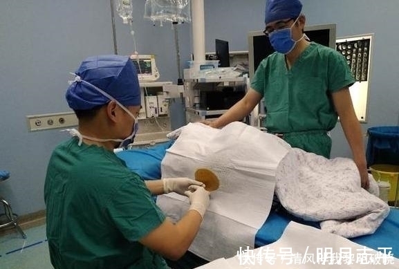 腹腔粘连|第二次剖腹产会比第一次更痛吗?医生说出了答案,女性最好要知道