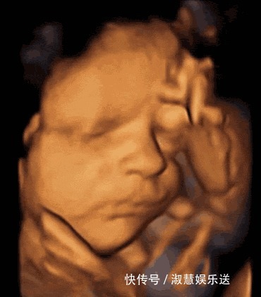 胎儿|除了睡觉,胎儿在妈妈肚子里干啥呢每个妈妈都应该看看