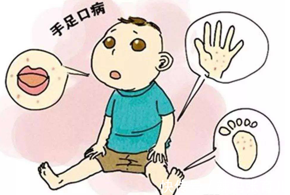 宝宝|原本以为夏季才是手足口病的高发期,没想到冬季也是