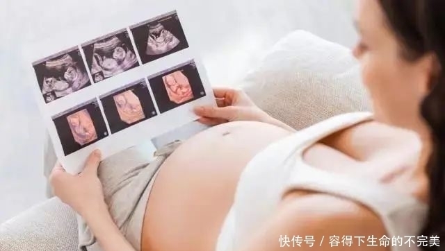 四维彩超|为什么我的四维彩超图像没有别人的清晰？