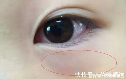 儿科|儿科医师提醒:宁愿孩子饿着,2种辅食也别给碰!当心孩子不发育