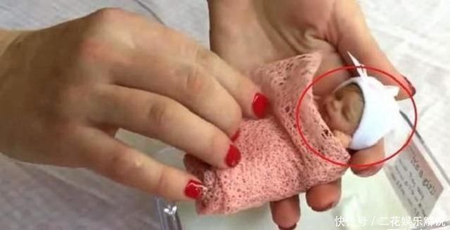 准妈妈|世界最小的婴儿已经14岁了,如今的现状,生活得有滋有味