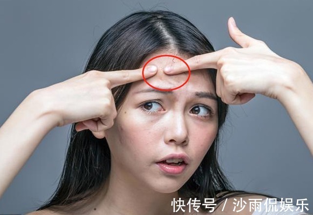 内分泌失调|女性有妇科炎症,脸上或许有4种表现,你若都不占,子宫很健康