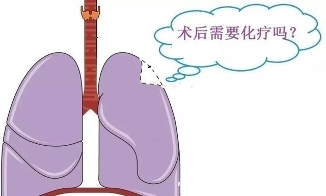 患者|原来有些癌症根本不需要化疗,反而会起到相反的效果,你中招了吗