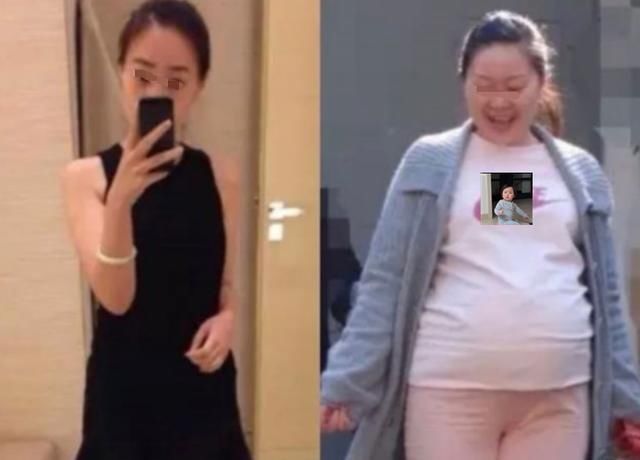 怀孕|怀孕后变丑太“烦恼”,孕妈了解原因的同时,调整心态也很重要