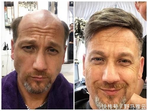 男士|戴假发的四大误区,每一个都让人尴尬到爆,你做对了吗?