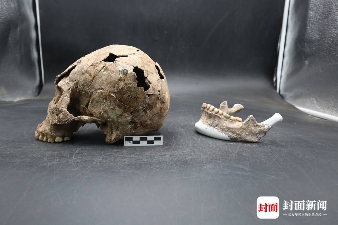 多学科|1500具人类遗骸中藏了多少历史密码？80后人骨鉴定专家“以骨释古”