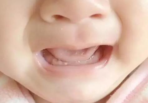 宝宝|宝宝身上的这些“奇怪现象”,根本不是病!别再带孩子往医院跑