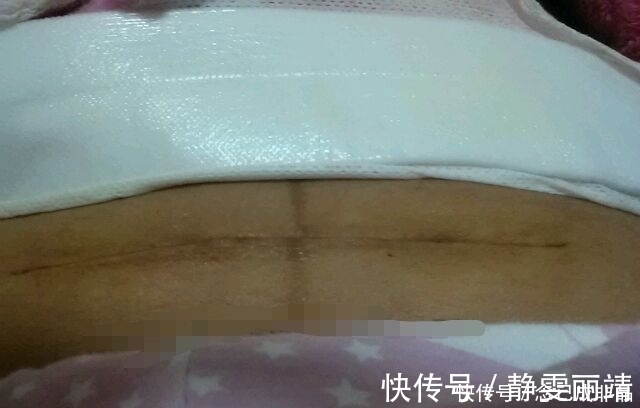 孕妈们|为什么很多女明星宁愿剖腹产也不选顺产呢这三个原因挺无奈的