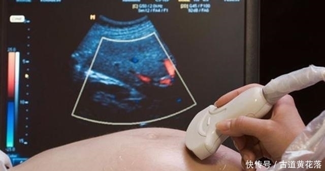 孕期|怀胎十月“注意事项”一览表,孕妈收藏备用,愿宝宝顺利出生!