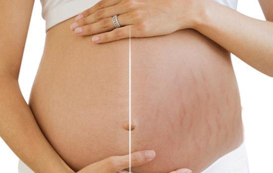 皮下组织|女人打胎后,身体会留下几种痕迹,医生也没法消除