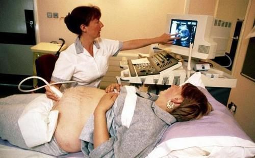 剖腹产|顺产比剖腹产强100倍?剖腹产这3大优点,顺产根本没法比