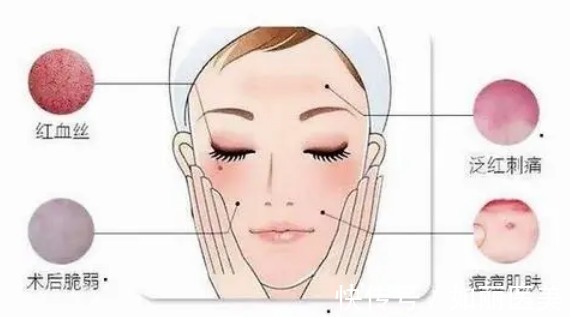 胶原蛋白 做完热玛吉后皮肤变黑正常吗?这几点要注意,不然白做了