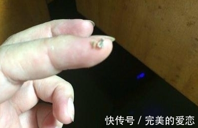 结石|男孩因口臭被孤立，爸爸带到医院去检查，张嘴后医生都吐了