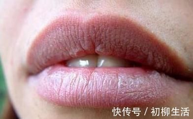 血栓|出现4个表现，血液已太粘稠！防血栓，谨记饭后三忌，睡前三不宜