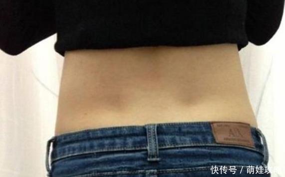 皮下组织|为什么有的女性腰后有2个“坑”，有什么作用？别羞于了解！