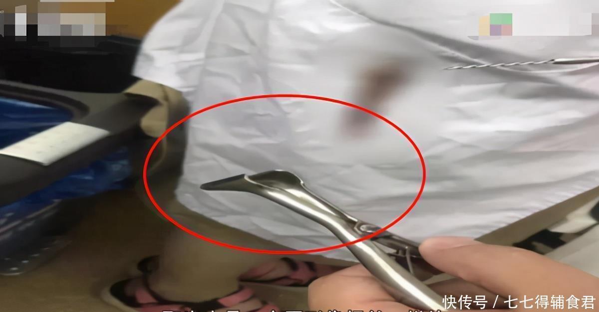 童童|3岁女孩裤子发臭,妈妈崩溃:这些东西是怎么跑进孩子身体里的?