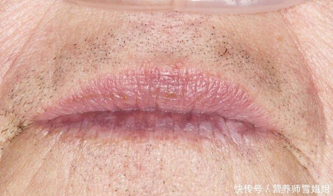 导致|肺不好的人,会出现6种迹象,若没有,恭喜,说明肺还算健康