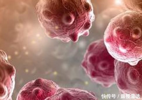 饮食习惯|治好的癌症为何又复发了，或许与5点有关，早了解早预防