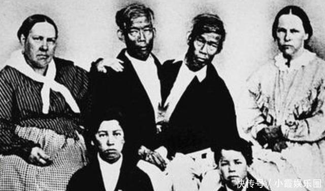 马戏团|泰国连体兄弟,在美国马戏团打拼10年,迎娶两姐妹,生了21个孩子