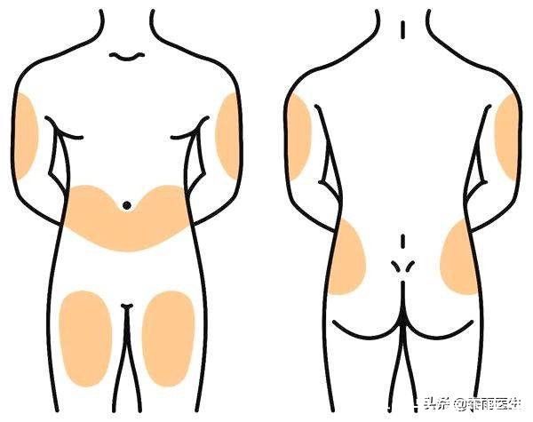 胰岛素|胰岛素针头复用立省3元？感染、增生等风险让你花更多钱受更多罪