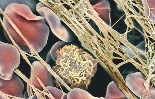 姬松茸粉|终于找到预防血栓的方法了！喝好一碗汤一杯水，让血管干净