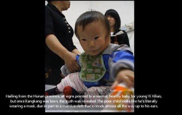 康康|宝宝安全出生,可妈妈看到宝宝的样子失声痛哭!