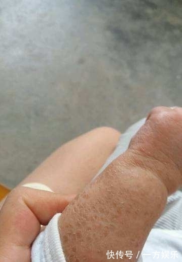 蛇酒|女子怀孕喝蛇酒,在医院生下宝宝后,家人脸色大变