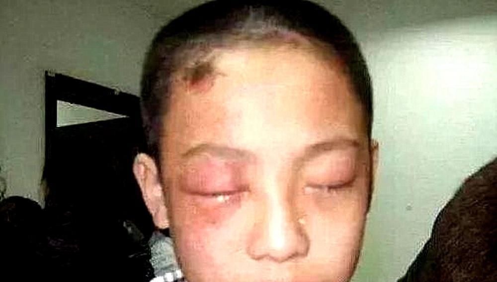 危险物品|5岁男娃眼睛被溶,几乎失明!这样的“玩具”,家长别让孩子碰