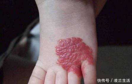 “血管堵,脚先知”!想要血管健康,少碰3物勤3事,血管变年轻