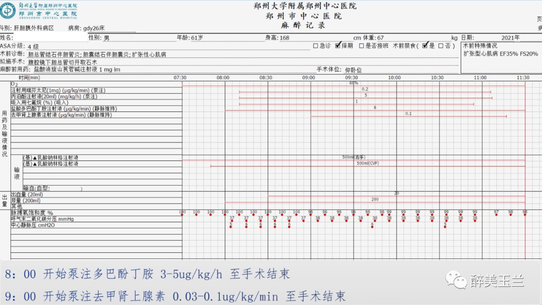 扩张型心肌病患者非心脏手术的全身麻醉一例|病例讨论 | 全身麻醉