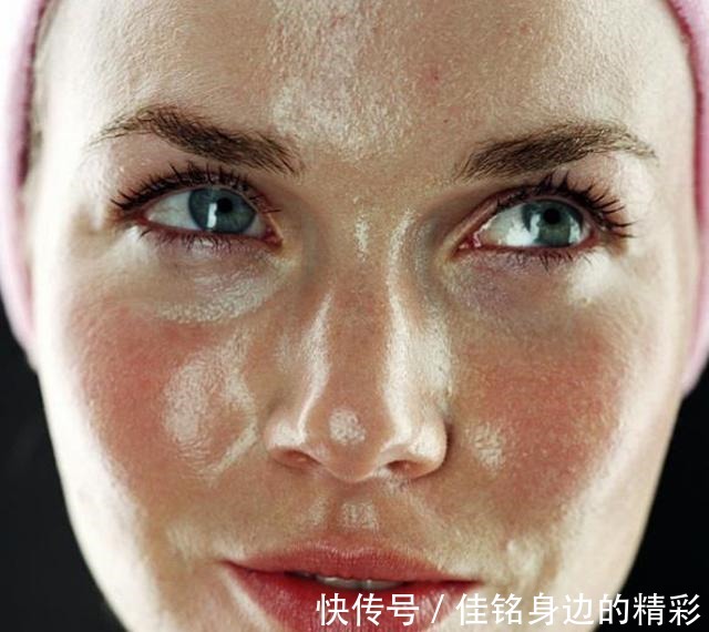 皮肤 皮肤老爱出油这几个护肤知识要知道,让你摆脱“大油田”!