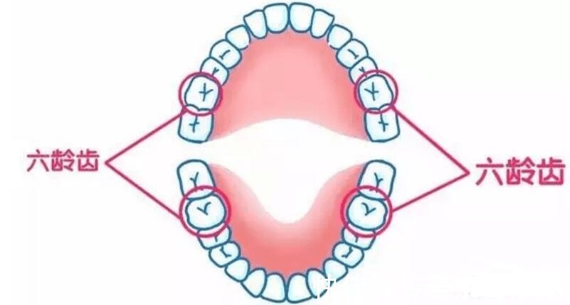 乳牙|家长必读权威专家提醒:必须在12岁前处理的10种儿童牙颌畸形