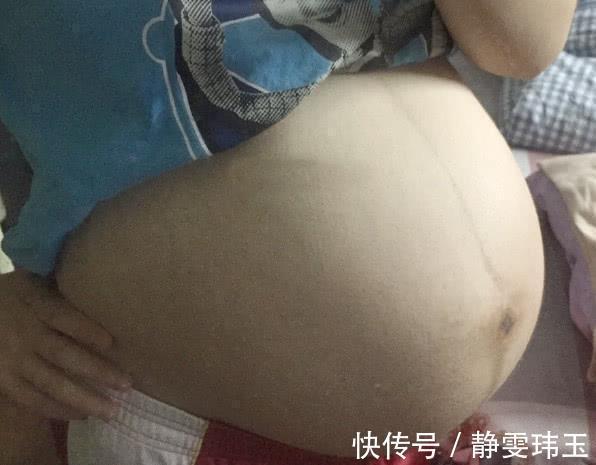 站立|孕期安全图鉴:孕妈站、坐、躺、弯腰、上下楼,这些细节都要注意