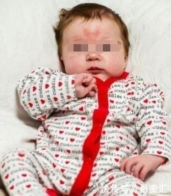 斯帕汉|小伙儿情人节为女友种草莓,意外怀孕,生下宝宝头上的胎记亮了