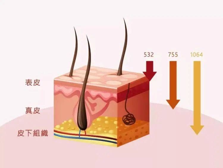 黑色素|松江医生为你揭秘超皮秒的神奇之处