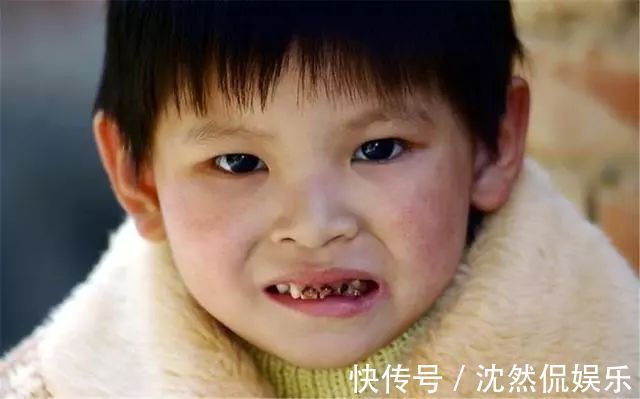 孩子|三岁大的娃,满口“小黑牙”,医生检查后坦言跟吃糖没有关系!