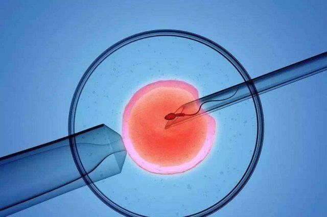 不孕不育|试管婴儿技术越发成熟,但它存在的4个弊端,未孕夫妻都了解吗