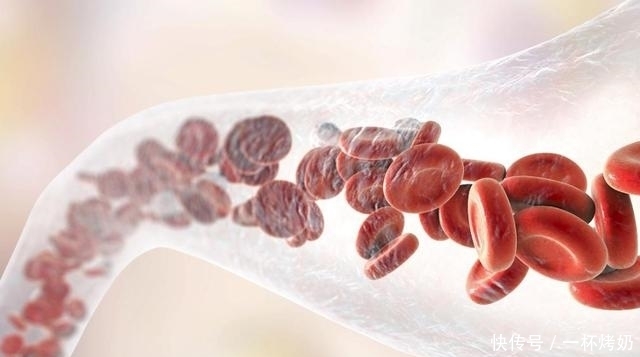 豆子|血管堵塞了,1种豆子,2种用法,再加上1个动作,彻底疏通血管