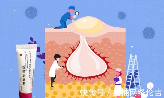 美白|玛恩医生-烟酰胺这四种功效你都知道吗修复美白控油抗衰!
